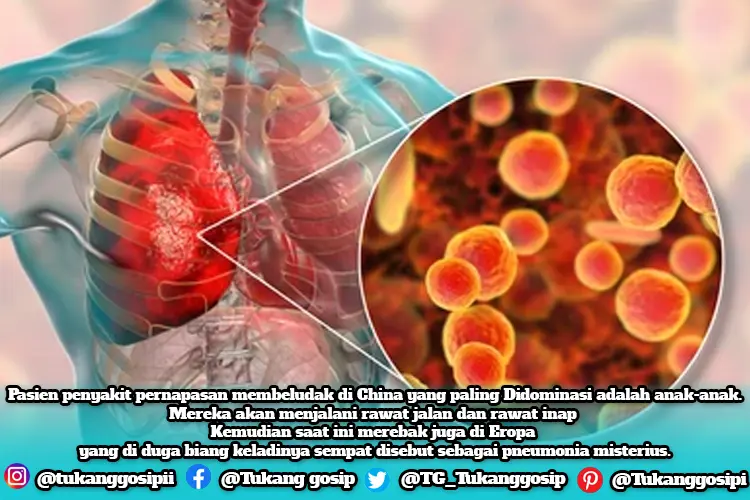 Mycoplasma Pneumonia Merebak Di China Dan Eropa, Simak Apa Saja Gejalanya